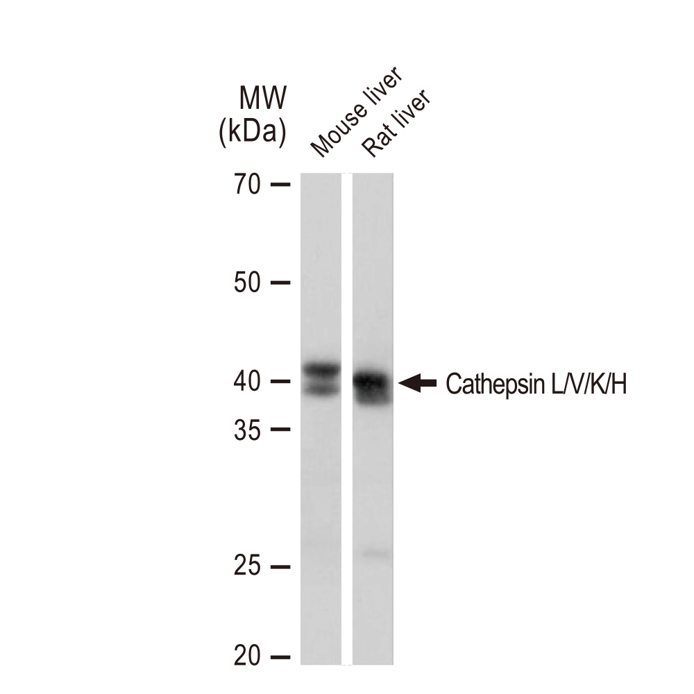 WB analysis of various samples using GTX02849 Cathepsin L/V/K/H antibody [GT1252]. Dilution : 1:1000 Loading : 25microg