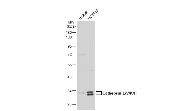 Various whole cell extracts (30 microg) were separated by 10% SDS-PAGE, and the membrane was blotted with Cathepsin L/V/K/H antibody [GT1252] (GTX02849) diluted at 1:1000. The HRP-conjugated anti-rabbit IgG antibody (GTX213110-01) was used to detect the primary antibody, and the signal was developed with Trident ECL plus-Enhanced.