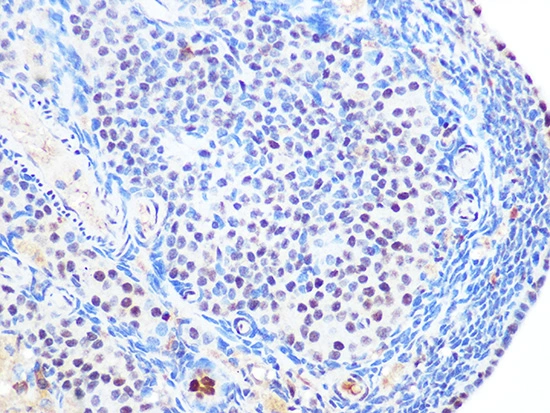 IHC-P analysis of rat ovary tissue section using GTX02850 SUMO2 + SUMO3 antibody [GT1253]. Dilution : 1:100
