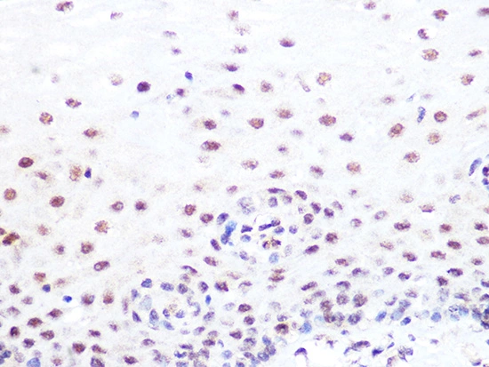 IHC-P analysis of human esophageal tissue section using GTX02850 SUMO2 + SUMO3 antibody [GT1253]. Dilution : 1:100