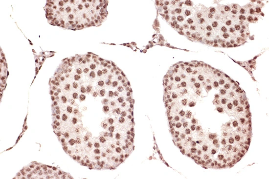 IHC-P analysis of rat testis tissue section using GTX02851 DDX17 antibody [GT1254]. Dilution : 1:100