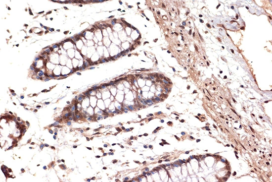 IHC-P analysis of human colon tissue section using GTX02851 DDX17 antibody [GT1254]. Dilution : 1:100