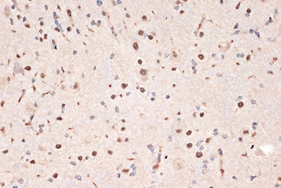 IHC-P analysis of mouse spinal cord section using GTX02851 DDX17 antibody [GT1254]. Dilution : 1:100