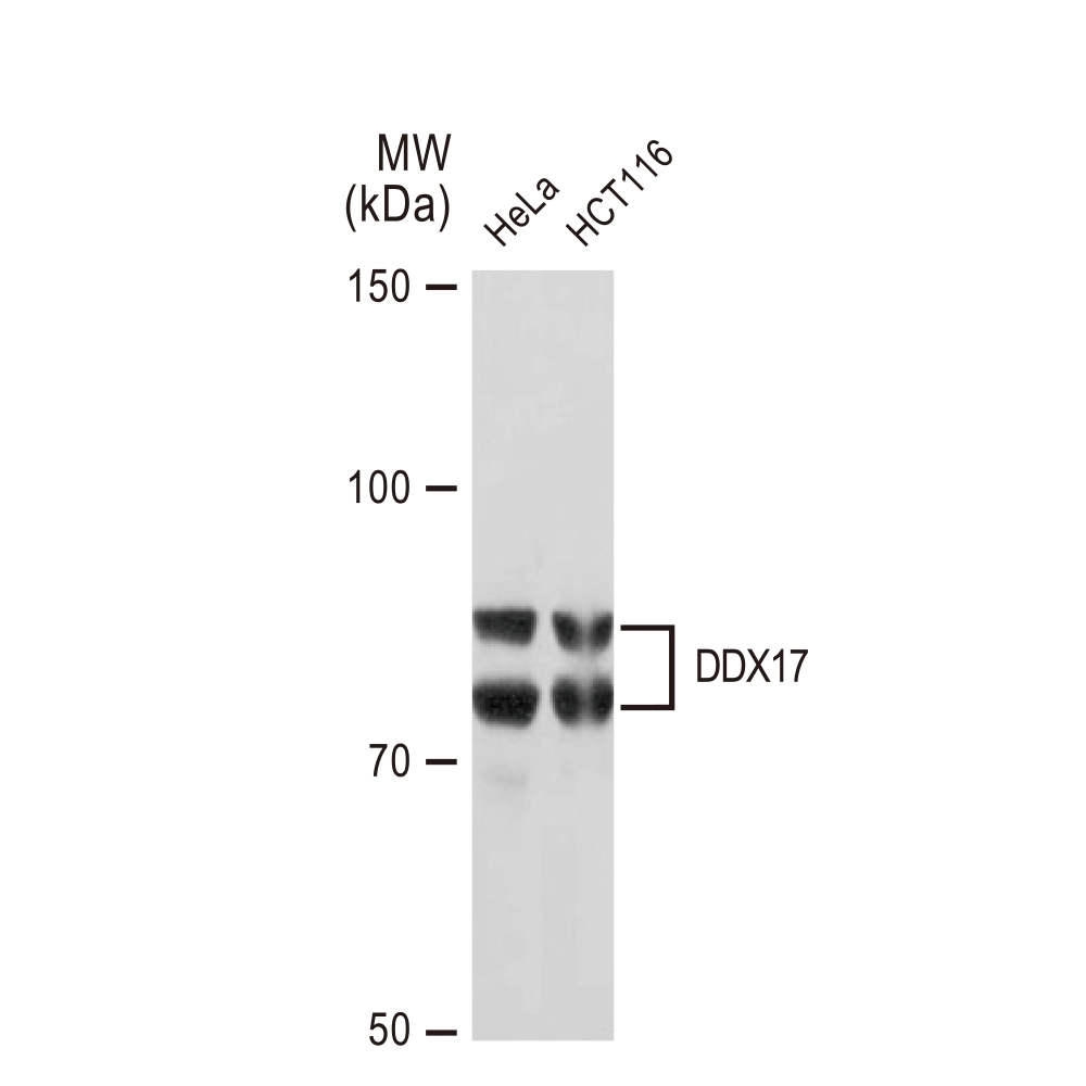 WB analysis of various samples using GTX02851 DDX17 antibody [GT1254]. Dilution : 1:1000 Loading : 25microg