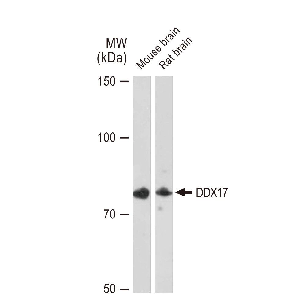 WB analysis of various samples using GTX02851 DDX17 antibody [GT1254]. Dilution : 1:1000 Loading : 25microg