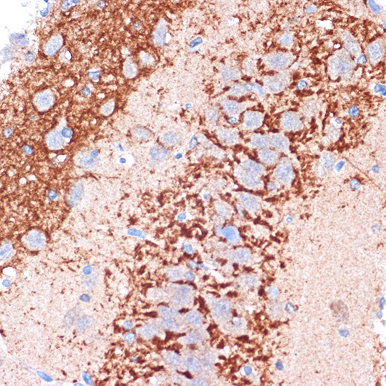 IHC-P analysis of rat brain tissue section using GTX02852 CDH13 antibody [GT1255]. Dilution : 1:100