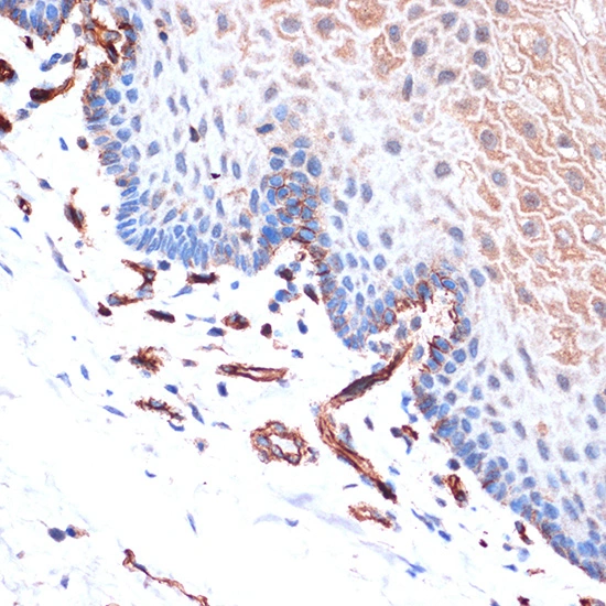 IHC-P analysis of human esophageal tissue section using GTX02852 CDH13 antibody [GT1255]. Dilution : 1:100