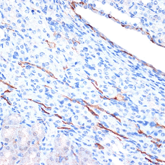 IHC-P analysis of mouse kidney tissue section using GTX02852 CDH13 antibody [GT1255]. Dilution : 1:100