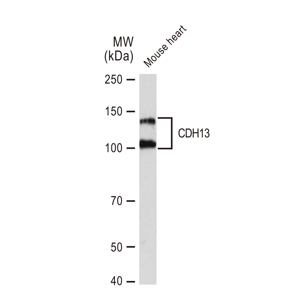 WB analysis of mouse heart tissue lysates using GTX02852 CDH13 antibody [GT1255]. Dilution : 1:1000 Loading : 25microg