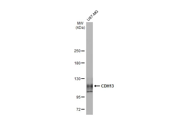 Whole cell extract (30 microg) was separated by 5% SDS-PAGE, and the membrane was blotted with CDH13 antibody [GT1255] (GTX02852) diluted at 1:500. The HRP-conjugated anti-rabbit IgG antibody (GTX213110-01) was used to detect the primary antibody.