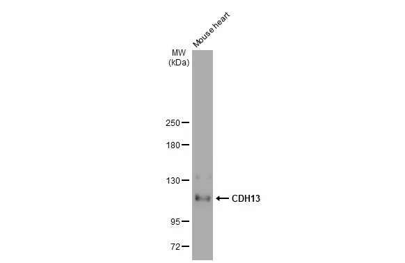 Mouse tissue extract (50 microg) was separated by 5% SDS-PAGE, and the membrane was blotted with CDH13 antibody [GT1255] (GTX02852) diluted at 1:1000. The HRP-conjugated anti-rabbit IgG antibody (GTX213110-01) was used to detect the primary antibody, and the signal was developed with Trident ECL plus-Enhanced.