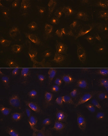 ICC/IF analysis of U2OS cells using GTX02853 Rab11A antibody [GT1256]. Dilution : 1:100 Blue : DAPI for nuclear staining.
