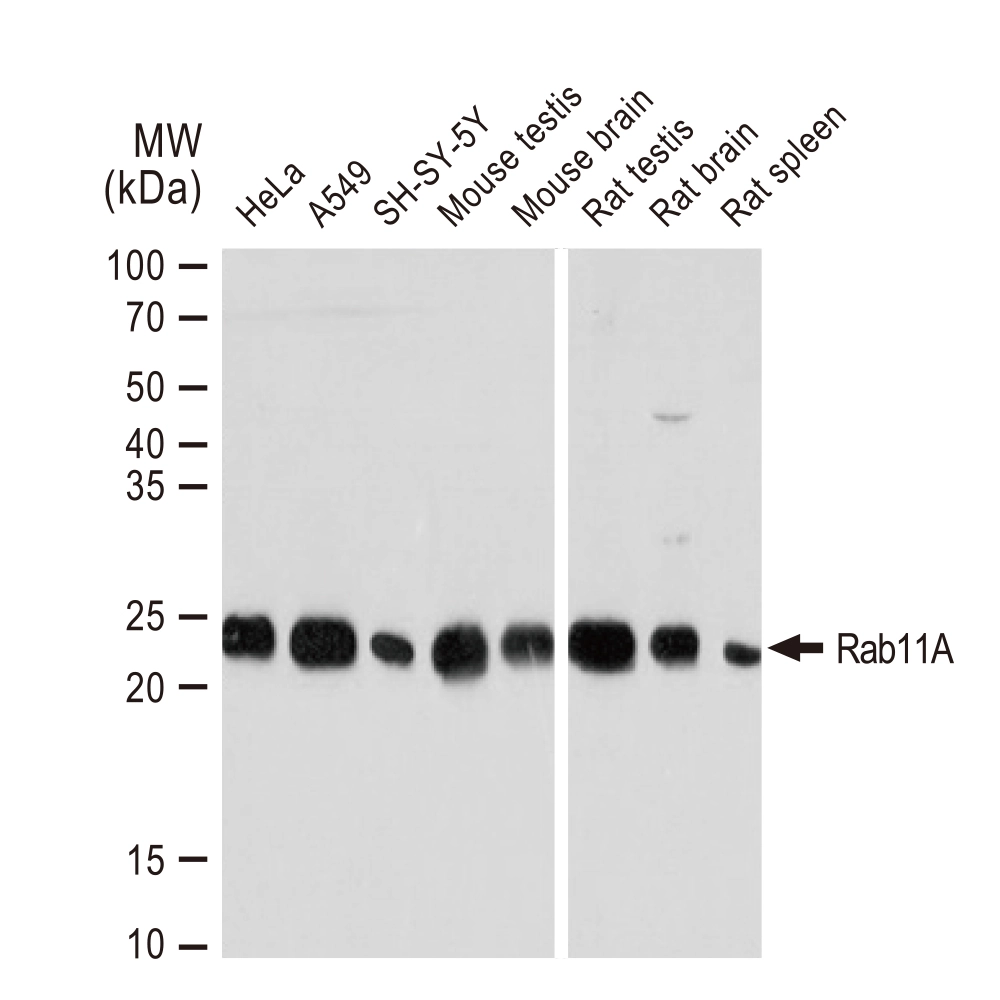 WB analysis of various samples using GTX02853 Rab11A antibody [GT1256]. Dilution : 1:1000 Loading : 25microg