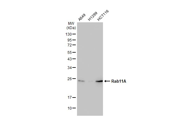 Various whole cell extracts (30 microg) were separated by 12% SDS-PAGE, and the membrane was blotted with Rab11A antibody [GT1256] (GTX02853) diluted at 1:1000. The HRP-conjugated anti-rabbit IgG antibody (GTX213110-01) was used to detect the primary antibody, and the signal was developed with Trident ECL plus-Enhanced.