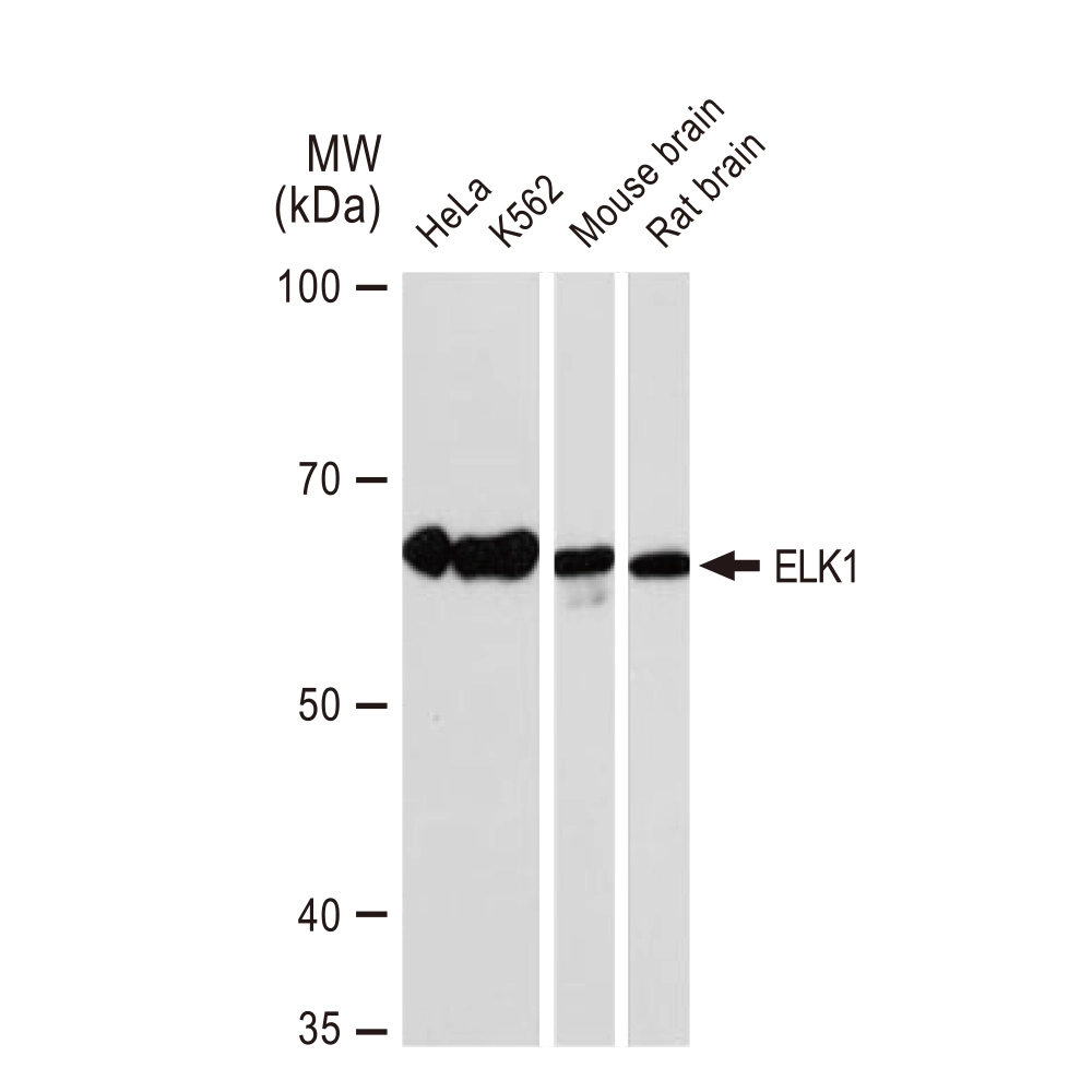 WB analysis of various samples using GTX02854 ELK1 antibody [GT1257]. Dilution : 1:1000 Loading : 25microg