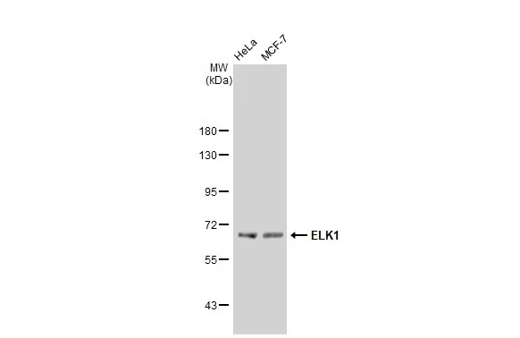 Various whole cell extracts (30 microg) were separated by 7.5% SDS-PAGE, and the membrane was blotted with ELK1 antibody [GT1257] (GTX02854) diluted at 1:1000. The HRP-conjugated anti-rabbit IgG antibody (GTX213110-01) was used to detect the primary antibody.