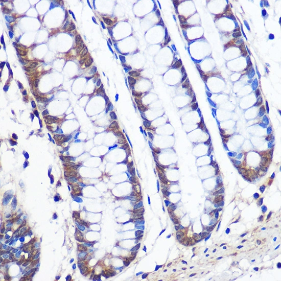 IHC-P analysis of human colon tissue section using GTX02855 ERK5 antibody [GT1258]. Dilution : 1:100