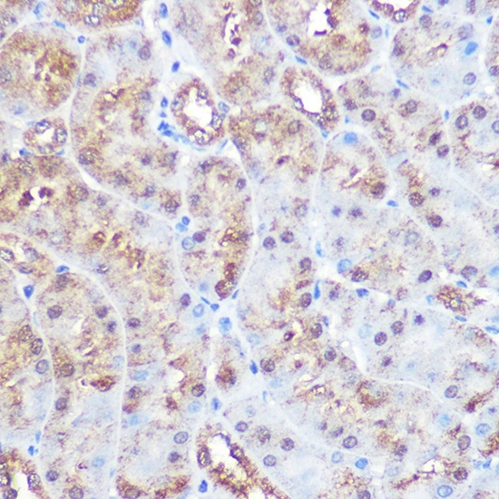 IHC-P analysis of mouse kidney tissue section using GTX02855 ERK5 antibody [GT1258]. Dilution : 1:100