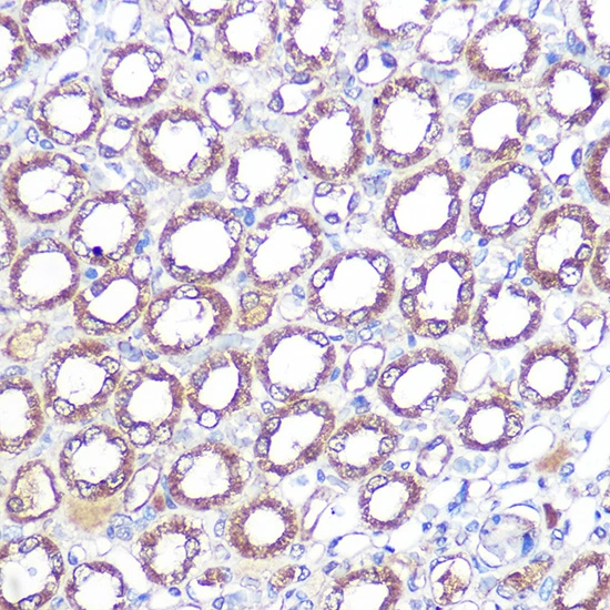 IHC-P analysis of mouse kidney tissue section using GTX02855 ERK5 antibody [GT1258]. Dilution : 1:100