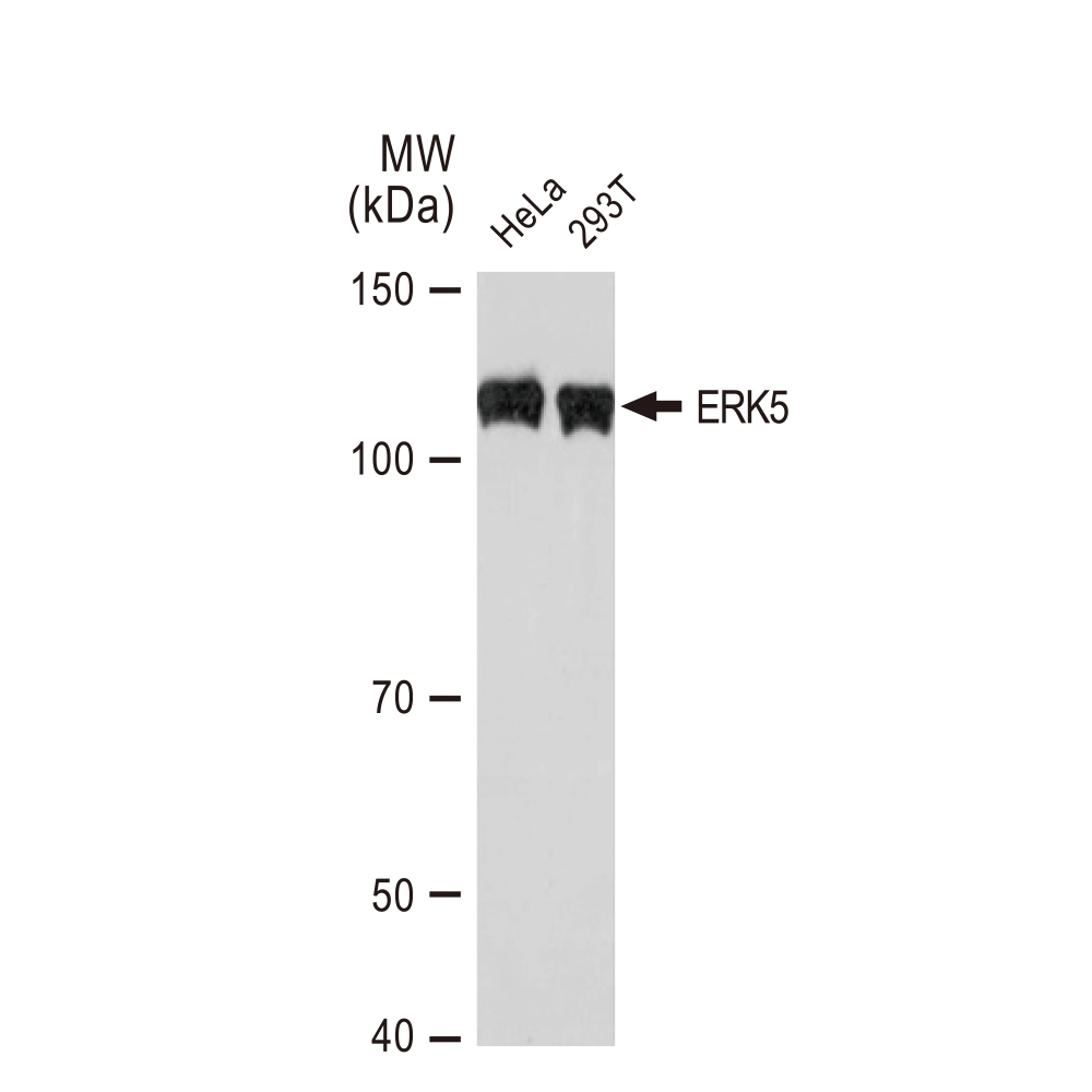 WB analysis of various samples using GTX02855 ERK5 antibody [GT1258]. Dilution : 1:500 Loading : 25microg