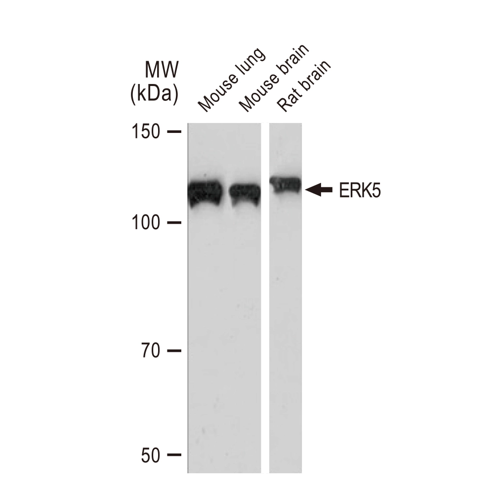 WB analysis of various samples using GTX02855 ERK5 antibody [GT1258]. Dilution : 1:500 Loading : 25microg