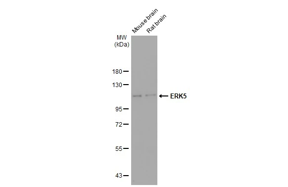 Various tissue extracts (50 microg) were separated by 7.5% SDS-PAGE, and the membrane was blotted with ERK5 antibody [GT1258] (GTX02855) diluted at 1:500. The HRP-conjugated anti-rabbit IgG antibody (GTX213110-01) was used to detect the primary antibody.