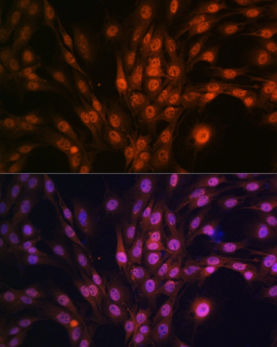 ICC/IF analysis of C6 cells using GTX02856 PAK2 antibody [GT1259]. Dilution : 1:100 Blue : DAPI for nuclear staining.