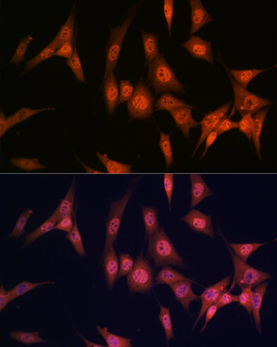 ICC/IF analysis of NIH-3T3 cells using GTX02856 PAK2 antibody [GT1259]. Dilution : 1:100 Blue : DAPI for nuclear staining.