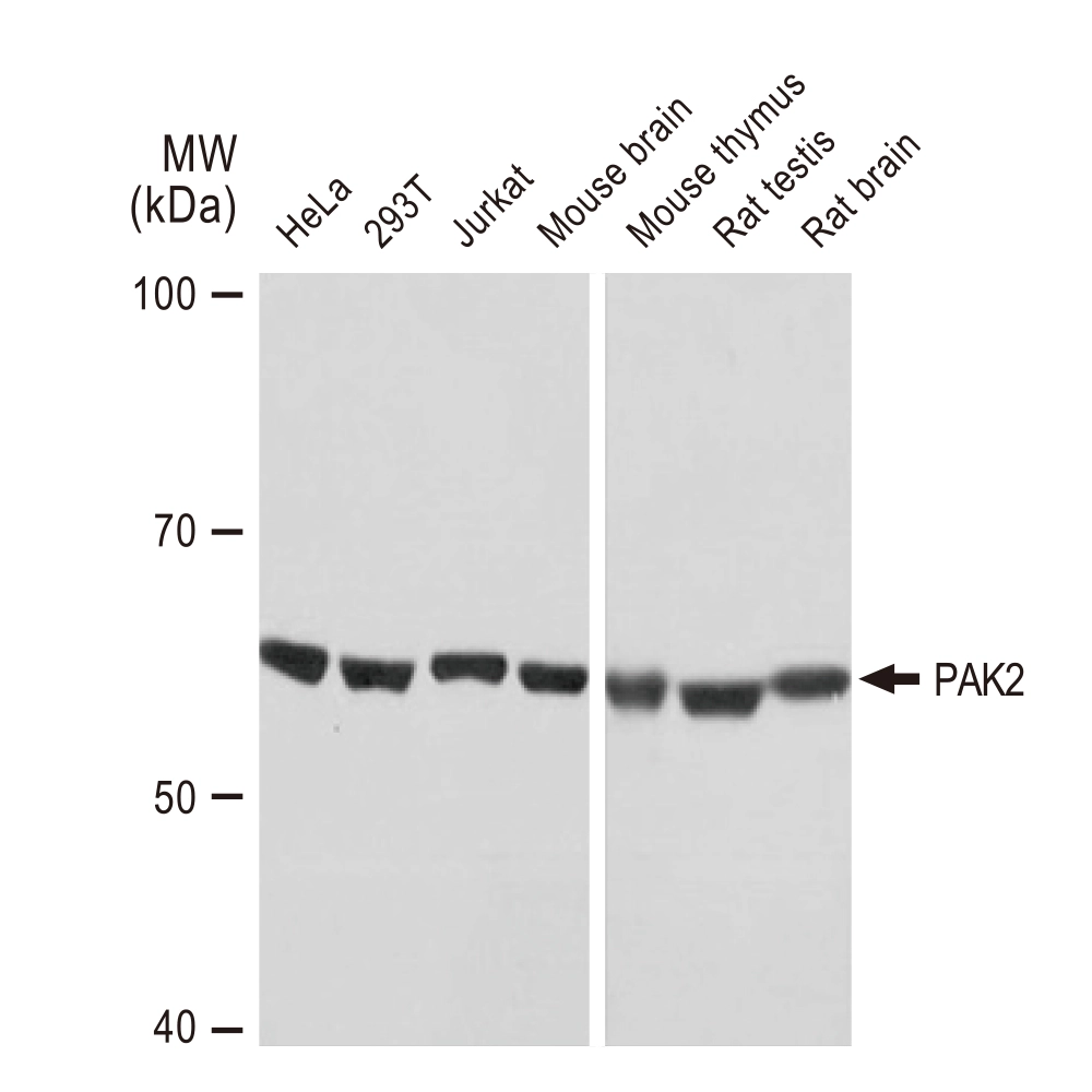 WB analysis of various samples using GTX02856 PAK2 antibody [GT1259]. Dilution : 1:1000 Loading : 25microg