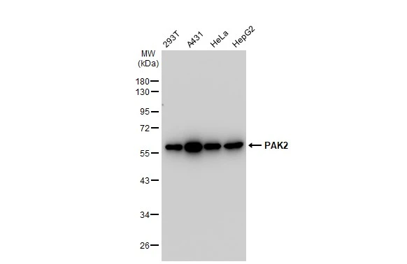 Various whole cell extracts (30 microg) were separated by 10% SDS-PAGE, and the membrane was blotted with PAK2 antibody [GT1259] (GTX02856) diluted at 1:1000. The HRP-conjugated anti-rabbit IgG antibody (GTX213110-01) was used to detect the primary antibody.