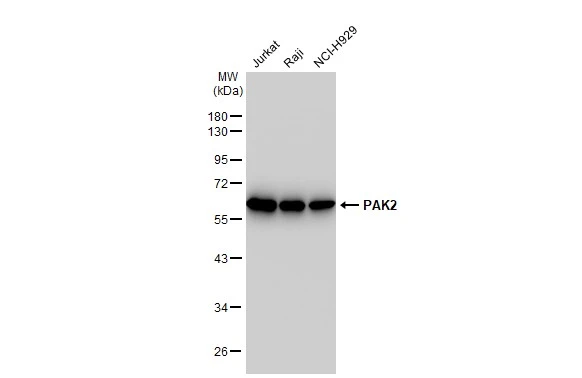 Various whole cell extracts (30 microg) were separated by 10% SDS-PAGE, and the membrane was blotted with PAK2 antibody [GT1259] (GTX02856) diluted at 1:1000. The HRP-conjugated anti-rabbit IgG antibody (GTX213110-01) was used to detect the primary antibody.