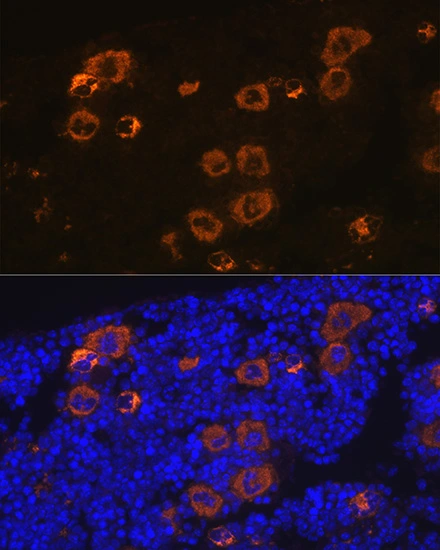 IHC-P analysis of mouse bone marrow section using PF4 antibody [GT1260] PF4 antibody [GT1260]. Dilution : 1:100 Blue : DAPI for nuclear staining.