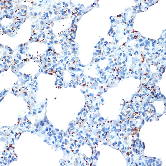 IHC-P analysis of rat lung tissue section using GTX02857 PF4 antibody [GT1260]. Dilution : 1:100