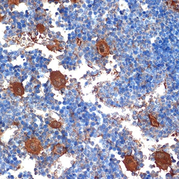 IHC-P analysis of mouse bone marrow section using GTX02857 PF4 antibody [GT1260]. Dilution : 1:100