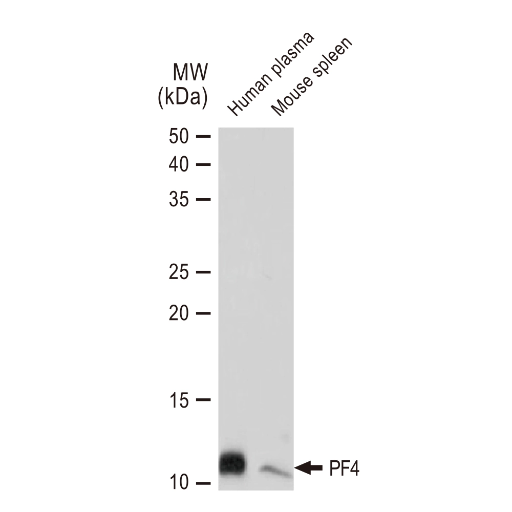 WB analysis of various samples using GTX02857 PF4 antibody [GT1260]. Dilution : 1:1000 Loading : 25microg