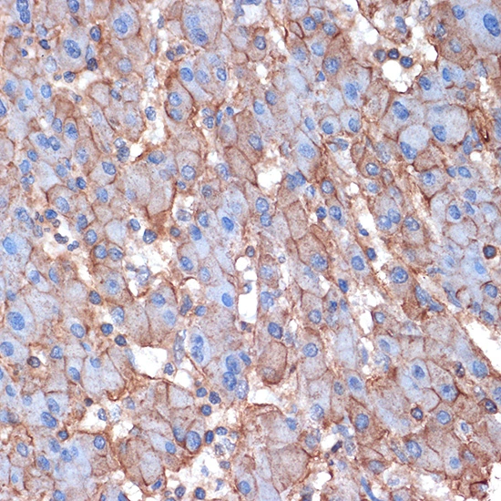 IHC-P analysis of human liver tissue section using GTX02858 alpha Fodrin antibody [GT1261]. Dilution : 1:100