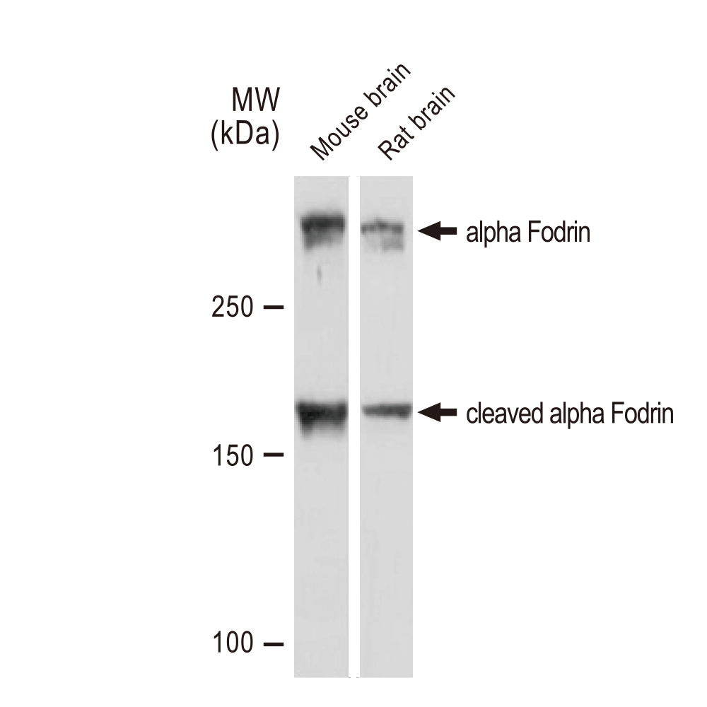 WB analysis of various samples using GTX02858 alpha Fodrin antibody [GT1261]. Dilution : 1:1000 Loading : 25microg