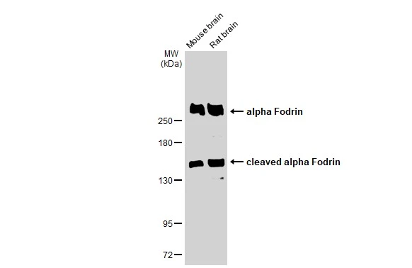 Various tissue extracts (50 microg) were separated by 5% SDS-PAGE, and the membrane was blotted with alpha Fodrin antibody [GT1261] (GTX02858) diluted at 1:20000. The HRP-conjugated anti-rabbit IgG antibody (GTX213110-01) was used to detect the primary antibody.
