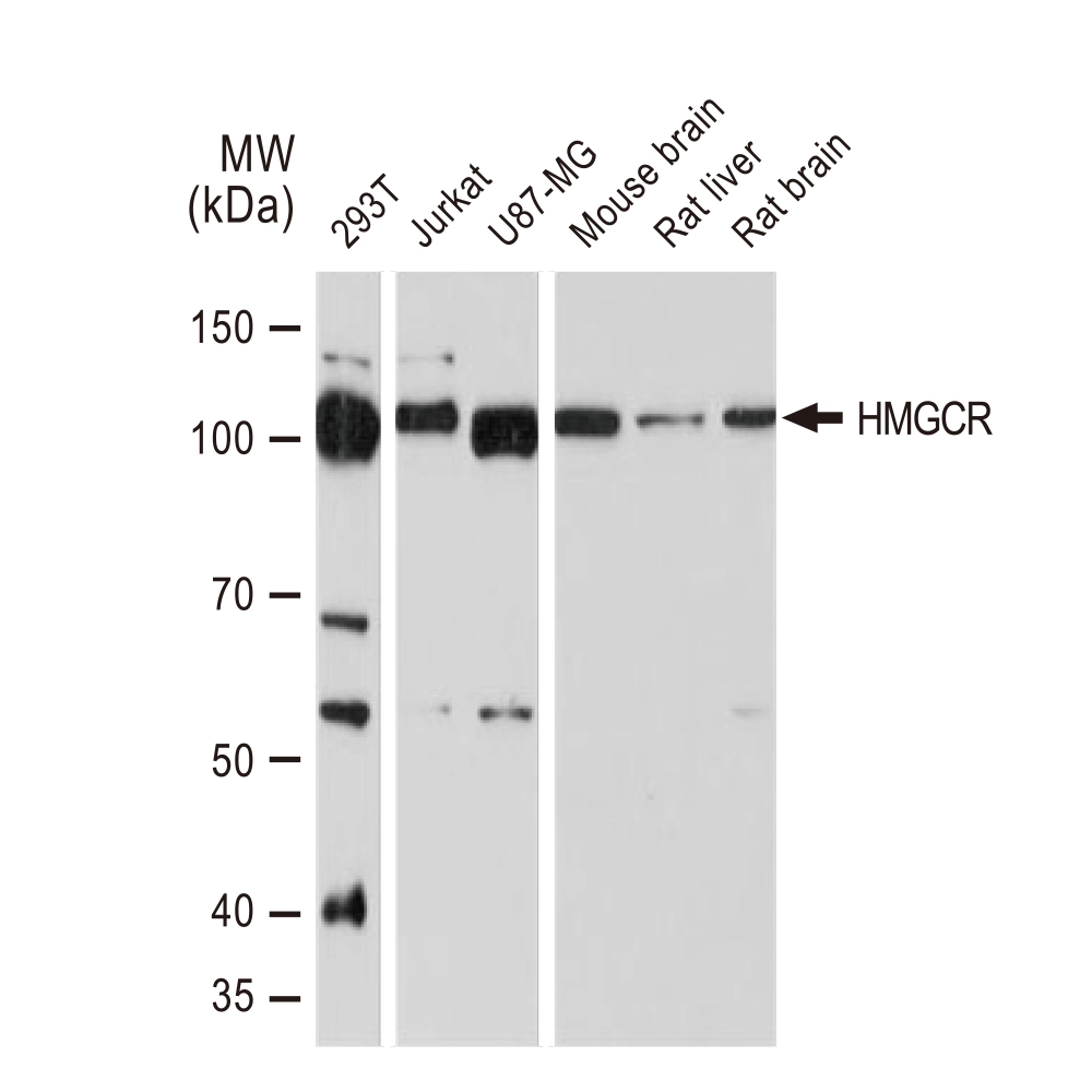 WB analysis of various samples using GTX02859 HMGCR antibody [GT1262]. Dilution : 1:1000 Loading : 25microg