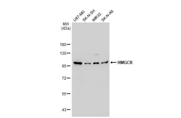 Various whole cell extracts (30 microg) were separated by 7.5% SDS-PAGE, and the membrane was blotted with HMGCR antibody [GT1262] (GTX02859) diluted at 1:1000. The HRP-conjugated anti-rabbit IgG antibody (GTX213110-01) was used to detect the primary antibody.