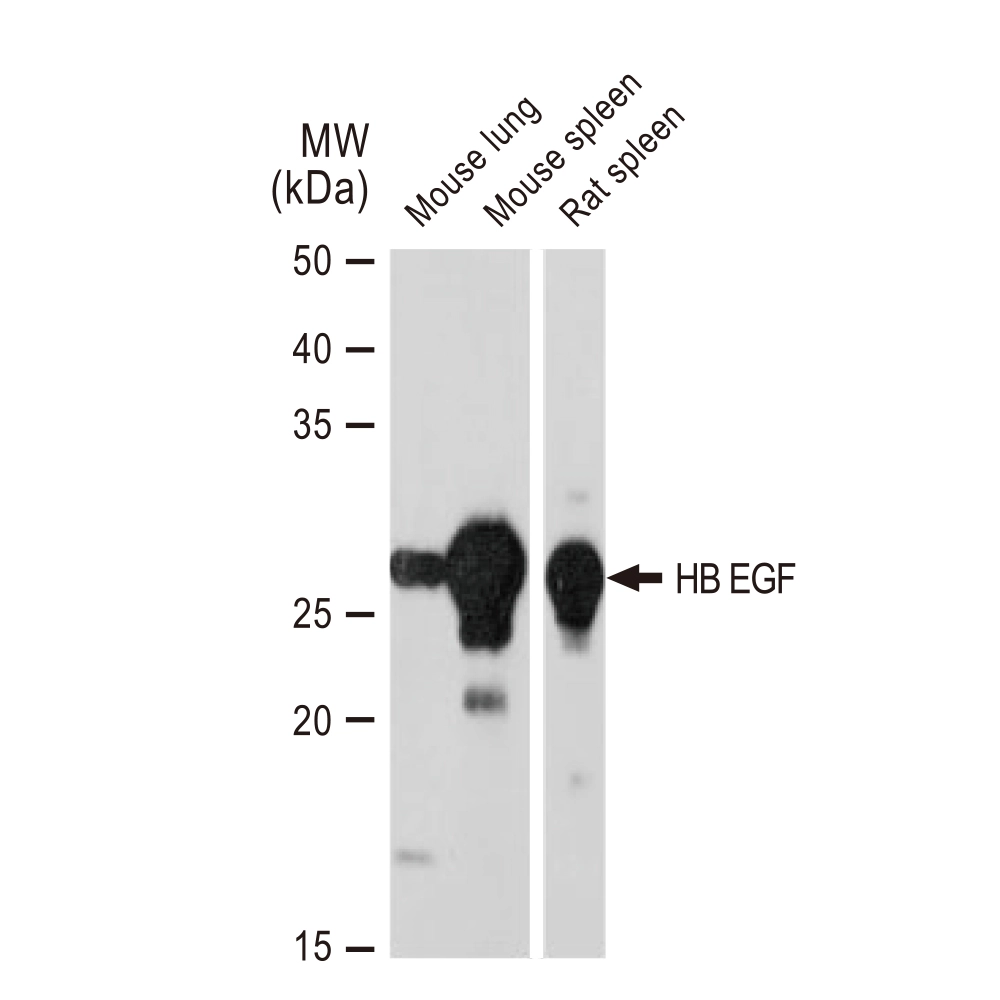 WB analysis of various samples using GTX02860 HB EGF antibody [GT1263]. Dilution : 1:1000 Loading : 25microg