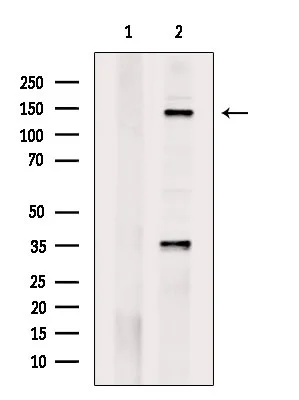 WB analysis of extracts from heat-shock treated EC304 cells using GTX02868 c-Met (phospho Tyr1234) antibody. The lane on the left was treated with blocking peptide.