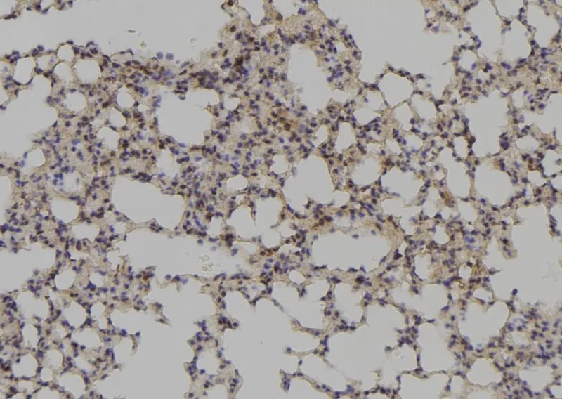 IHC-P analysis of mouse lung tissue using GTX02870 PAX1 antibody. Antigen retrieval : Heat mediated antigen retrieval step in citrate buffer was performed Dilution : 1:100