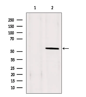 WB analysis of extracts from HeLa using GTX02870 PAX1 antibody. Lane 1 was treated with the blocking peptide.