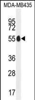 WB analysis of MDA-MB435 cell lysate using GTX02871 PAX1 antibody. Loading : 35microg/lane