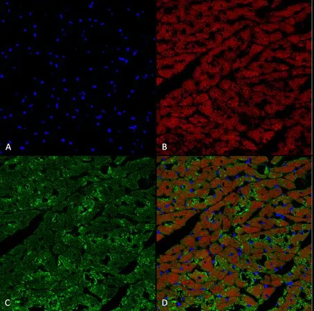 IHC-P analysis of rat heart tissue using GTX02872 Hexanoyl-Lysine adduct antibody [5D9]. Dilution : 1:25 Green : Primary antibody Blue : DAPI Red : Actin