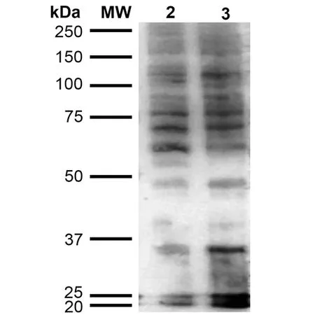 WB analysis of HeLa cell lysate using GTX02872 Hexanoyl-Lysine adduct antibody [5D9]. Lane 1 : Molecular Weight Ladder (MW) Lane 2 : HeLa cell lysate Lane 3 : H2O2 treated HeLa cell lysate Loading : 12 microg Dilution : 1:1000