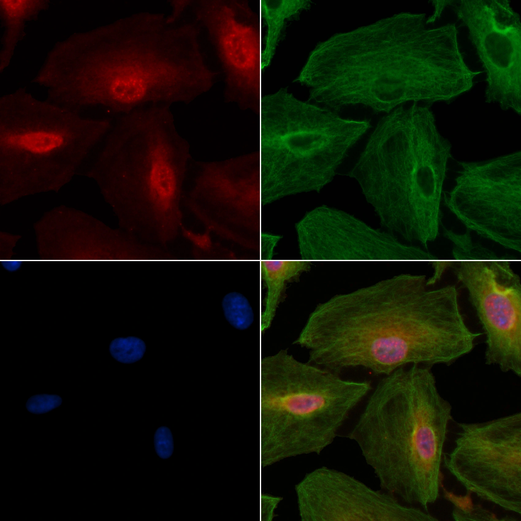 ICC/IF analysis of PFA-fixed A549 cells (4h of LPS treatment) using GTX02873 NRF2 (phospho Ser40) antibody. Red : Primary antibody Green : beta tubulin Blue : DAPI Permeabilization : 0.1% Triton X-100
