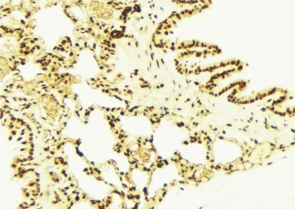 IHC-P analysis of mouse lung tissue using GTX02873 NRF2 (phospho Ser40) antibody. Antigen retrieval : Heat mediated antigen retrieval step in citrate buffer was performed Dilution : 1:100