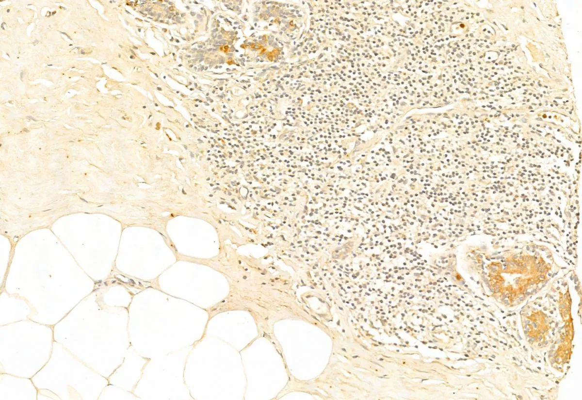 IHC-P analysis of human normal tissues adjacent to mammary cancer using GTX02873 NRF2 (phospho Ser40) antibody. Antigen retrieval : Heat mediated antigen retrieval step in citrate buffer was performed Dilution : 1:100